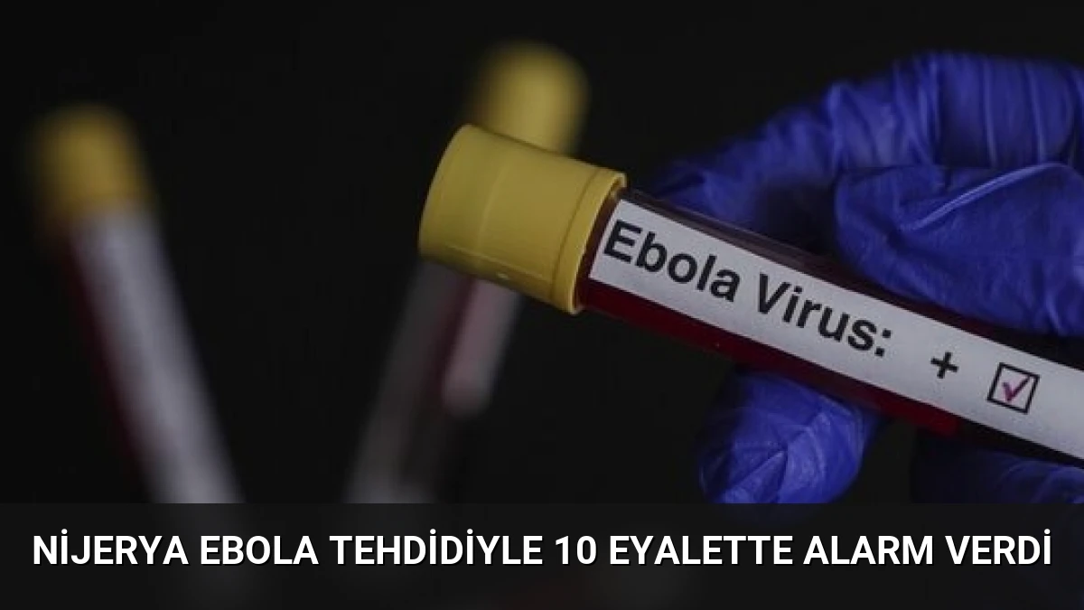 Nijerya Ebola Tehdidiyle 10 Eyalette Alarm Verdi